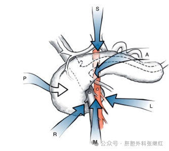 谈谈胰十二指肠切除术（四）